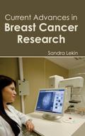 Current Advances in Breast Cancer Research