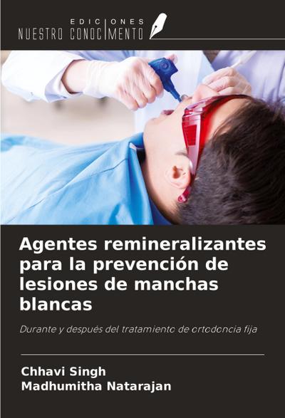 Agentes remineralizantes para la prevención de lesiones de manchas blancas