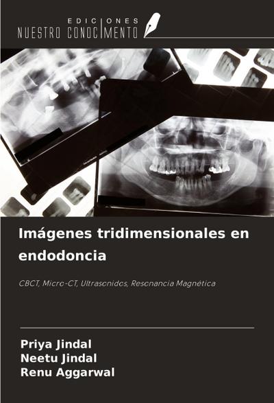 Imágenes tridimensionales en endodoncia