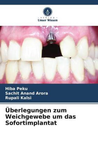 Überlegungen zum Weichgewebe um das Sofortimplantat