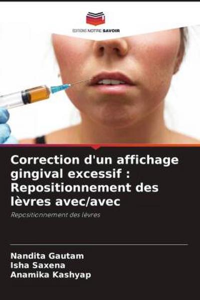 Correction d’un affichage gingival excessif : Repositionnement des lèvres avec/avec