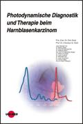 Photodynamische Diagnostik und Therapie beim Harnblasenkarzinom