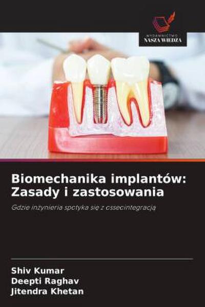 Biomechanika implantów: Zasady i zastosowania