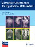 Corrective Osteotomies for Rigid Spinal Deformities