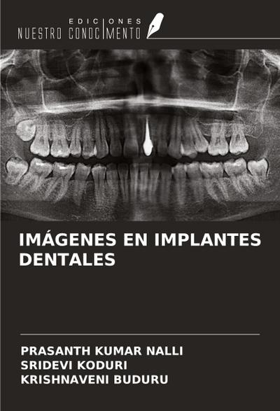 IMÁGENES EN IMPLANTES DENTALES