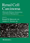 Renal Cell Carcinoma