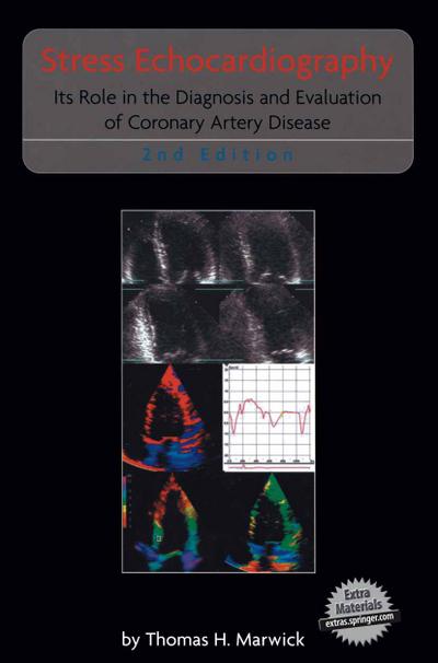 Stress Echocardiography