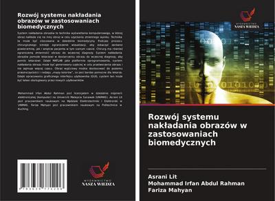 Rozwój systemu nak¿adania obrazów w zastosowaniach biomedycznych