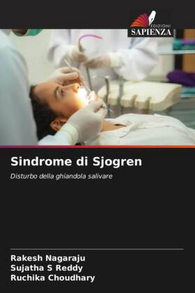 Sindrome di Sjogren