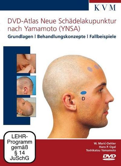DVD-Atlas Neue Schädelakupunktur nach Yamamoto (YNSA), 1 DVD