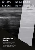 Diagnóstico del neumotórax por ecografía