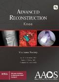 AAOS Advanced Reconstruction Knee