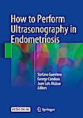How to Perform Ultrasonography in Endometriosis