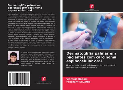Dermatoglifia palmar em pacientes com carcinoma espinocelular oral