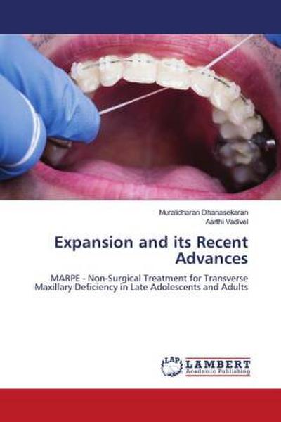 Expansion and its Recent Advances