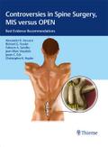 Controversies in Spine Surgery, MIS versus OPEN