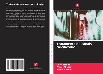Tratamento de canais calcificados