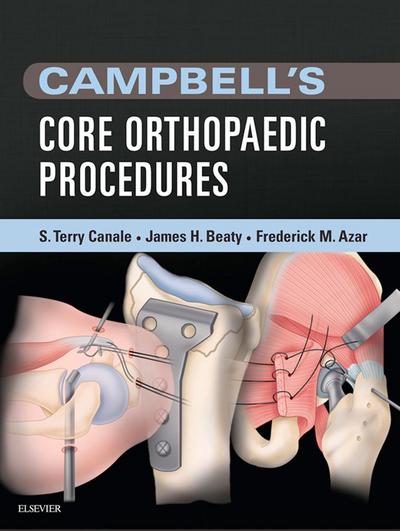 Campbell’s Core Orthopaedic Procedures E-Book