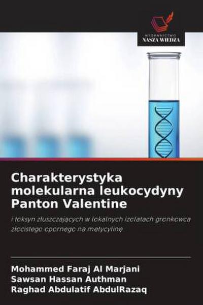 Charakterystyka molekularna leukocydyny Panton Valentine
