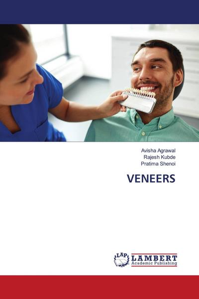 VENEERS