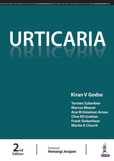 Urticaria