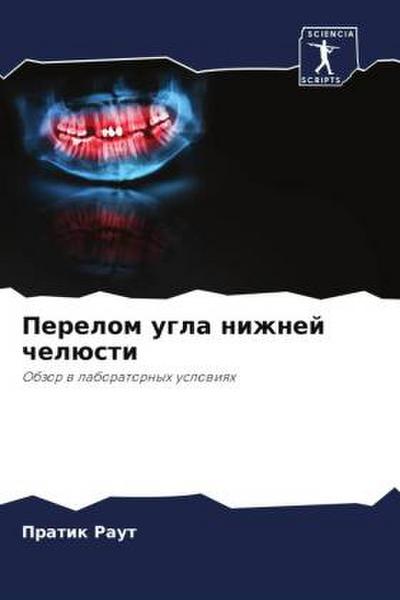 Perelom ugla nizhnej chelüsti