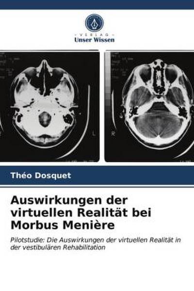 Auswirkungen der virtuellen Realität bei Morbus Menière
