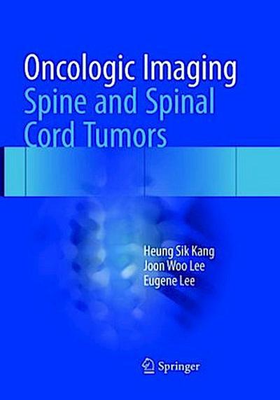 Oncologic Imaging: Spine and Spinal Cord Tumors