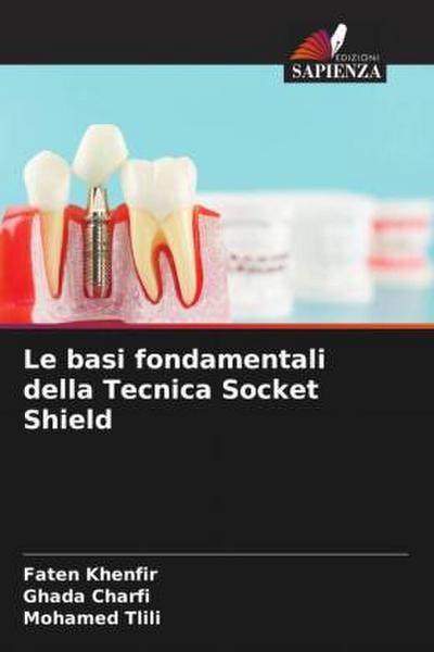 Le basi fondamentali della Tecnica Socket Shield