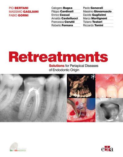 Retreatment. Solutions for Apical Diseases of Endodontic Origin