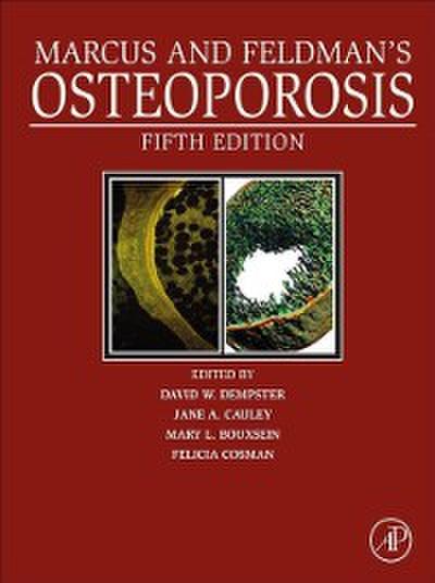 Marcus and Feldman’s Osteoporosis