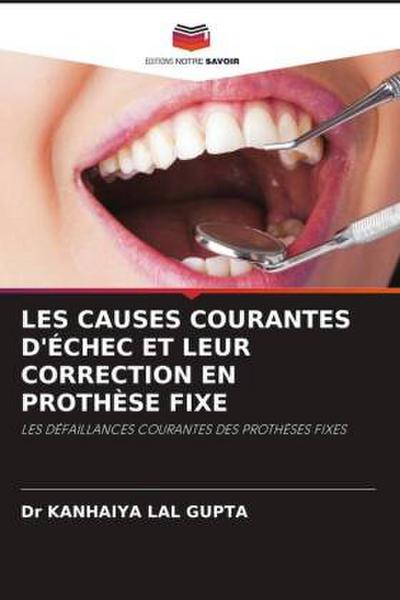 LES CAUSES COURANTES D’ÉCHEC ET LEUR CORRECTION EN PROTHÈSE FIXE