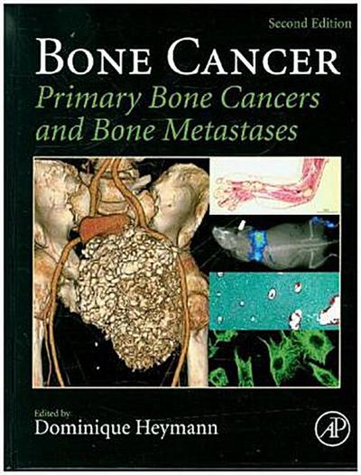 Bone Cancer