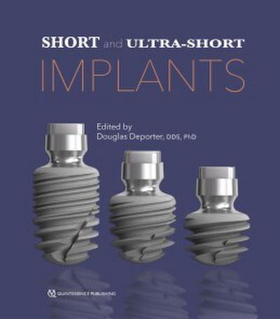 Short and Ultra-Short Implants (eBook, PDF) - Douglas Deporter
