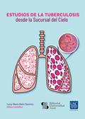 Estudios de la tuberculosis desde la Sucursal del Cielo