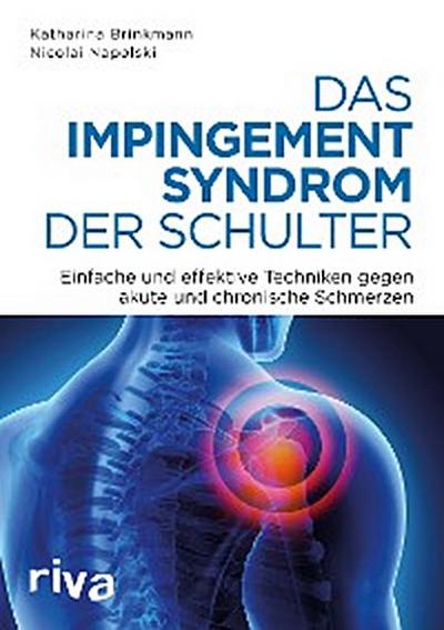 Das Impingement-Syndrom der Schulter