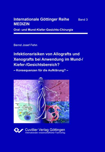 Infektionsrisiken von Allografts und Xenografts bei Anwendung im Mund-/Kiefer-/Gesichtsbereich?. Konsequenzen für die Aufklärung?