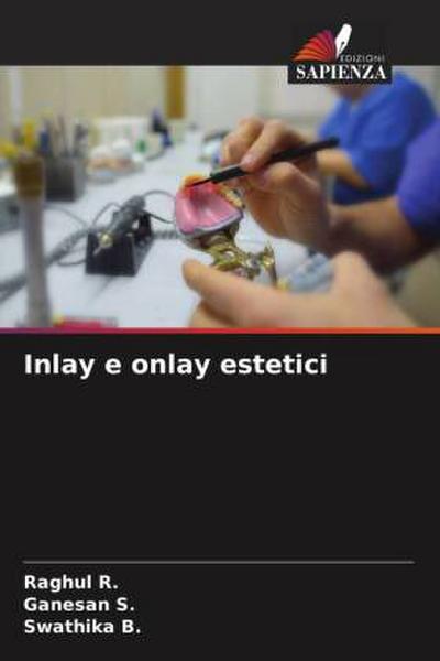 Inlay e onlay estetici