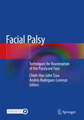 Facial Palsy