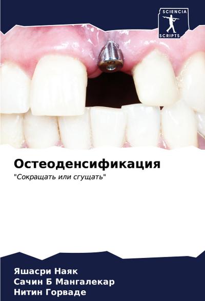 Osteodensifikaciq