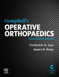 Campbell’s Operative Orthopaedics, E-Book
