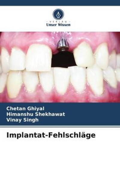 Implantat-Fehlschläge