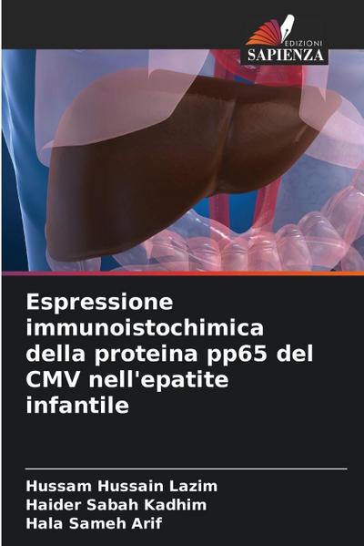 Espressione immunoistochimica della proteina pp65 del CMV nell’epatite infantile