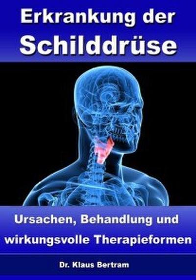 Erkrankung der Schilddrüse - Ursachen, Behandlung und wirkungsvolle Therapieformen