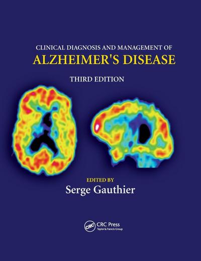 Clinical Diagnosis and Management of Alzheimer’s Disease