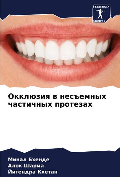 Okklüziq w nes#emnyh chastichnyh protezah