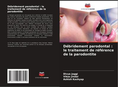 Débridement parodontal : le traitement de référence de la parodontite