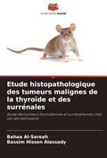 Etude histopathologique des tumeurs malignes de la thyroïde et des surrénales