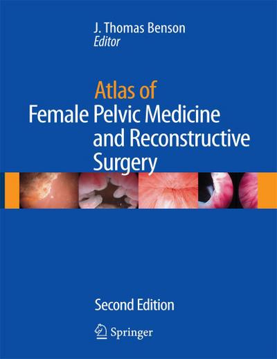Atlas of Female Pelvic Medicine and Reconstructive Surgery