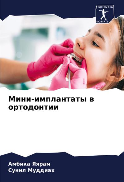 Mini-implantaty w ortodontii